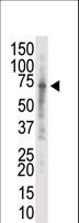 IRAK2 / IRAK-2 Antibody - Western blot of anti-IRAK2 antibody in K562 cell lysate. IRAK2 (Arrow) was detected using purified antibody. Secondary HRP-anti-rabbit was used for signal visualization with chemiluminescence.