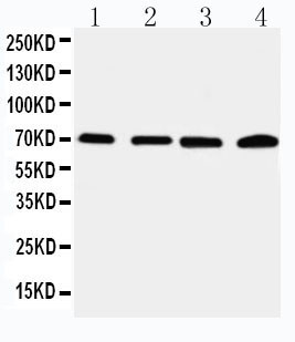 IRAK2 / IRAK-2 Antibody - WB of IRAK2 / IRAK-2 antibody. Lane 1: 22RV Cell Lysate. Lane 2: A549 Cell Lysate. Lane 3: PANC Cell Lysate. Lane 4: SMMC Cell Lysate.