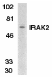 IRAK2 / IRAK-2 Antibody - Western blot of IRAK2 in K562 whole cell lysate with IRAK2 antibody at 1 ug/ml.