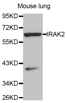 IRAK2 / IRAK-2 Antibody - Western blot analysis of extracts of Mouse lung tissue.