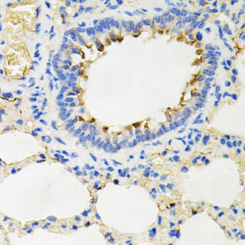 IRAK2 / IRAK-2 Antibody - Immunohistochemistry of paraffin-embedded rat lung tissue.