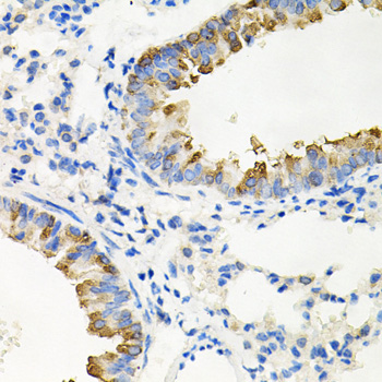 IRAK2 / IRAK-2 Antibody - Immunohistochemistry of paraffin-embedded mouse lung tissue.