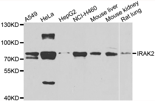 IRAK2 / IRAK-2 Antibody - Western blot analysis of extracts of various cell lines.