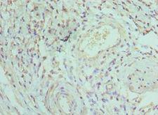 IRAK3 / IRAKM / IRAK-M Antibody - Immunohistochemistry of paraffin-embedded human epityphlon using antibody at 1:100 dilution.