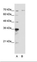 IRAK3 / IRAKM / IRAK-M Antibody - B: HepG2 Cell Lysate.  This image was taken for the unconjugated form of this product. Other forms have not been tested.