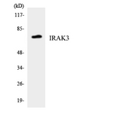 IRAK3 / IRAKM / IRAK-M Antibody - Western blot analysis of the lysates from HUVECcells using IRAK3 antibody.