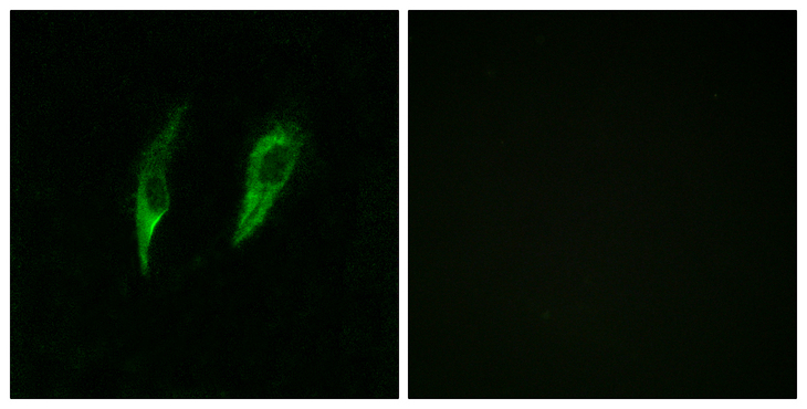 IRAK3 / IRAKM / IRAK-M Antibody - Immunofluorescence analysis of HeLa cells, using IRAK3 Antibody. The picture on the right is blocked with the synthesized peptide.