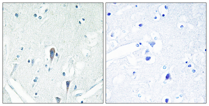 IRAK3 / IRAKM / IRAK-M Antibody - Immunohistochemistry analysis of paraffin-embedded human brain, using IRAK3 Antibody. The picture on the right is blocked with the synthesized peptide.