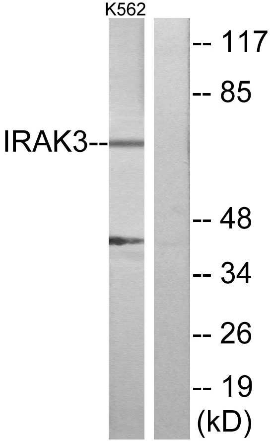 IRAK3 / IRAKM / IRAK-M Antibody - Western blot analysis of lysates from K562 cells, using IRAK3 Antibody. The lane on the right is blocked with the synthesized peptide.