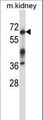 IRAK3 / IRAKM / IRAK-M Antibody - Mouse Irak3 Antibody western blot of mouse kidney tissue lysates (35 ug/lane). The Irak3 antibody detected the Irak3 protein (arrow).