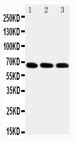 IRAK3 / IRAKM / IRAK-M Antibody - IRAKM antibody Western blot. Lane 1: HELA Cell Lysate. Lane 2: JURKAT Cell Lysate. Lane 3: HUT102 Cell Lysate.