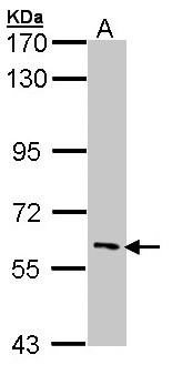 IRAK3 / IRAKM / IRAK-M Antibody - Sample (30 ug of whole cell lysate). A: Hep G2 . 7.5% SDS PAGE. IRAK3 / IRAK M antibody diluted at 1:1000.