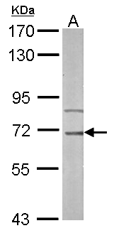 IRAK3 / IRAKM / IRAK-M Antibody - Sample (50 ug of whole cell lysate). A: mouse liver. 7.5% SDS PAGE. IRAK3 / IRAK M antibody diluted at 1:1000.