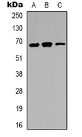 IRAK3 / IRAKM / IRAK-M Antibody - Western blot analysis of IRAK3 expression in LOVO (A); A431 (B); K562 (C) whole cell lysates.
