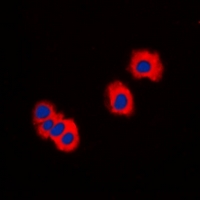 IRAK3 / IRAKM / IRAK-M Antibody - Immunofluorescent analysis of IRAK3 staining in LOVO cells. Formalin-fixed cells were permeabilized with 0.1% Triton X-100 in TBS for 5-10 minutes and blocked with 3% BSA-PBS for 30 minutes at room temperature. Cells were probed with the primary antibody in 3% BSA-PBS and incubated overnight at 4 deg C in a humidified chamber. Cells were washed with PBST and incubated with a DyLight 594-conjugated secondary antibody (red) in PBS at room temperature in the dark. DAPI was used to stain the cell nuclei (blue).