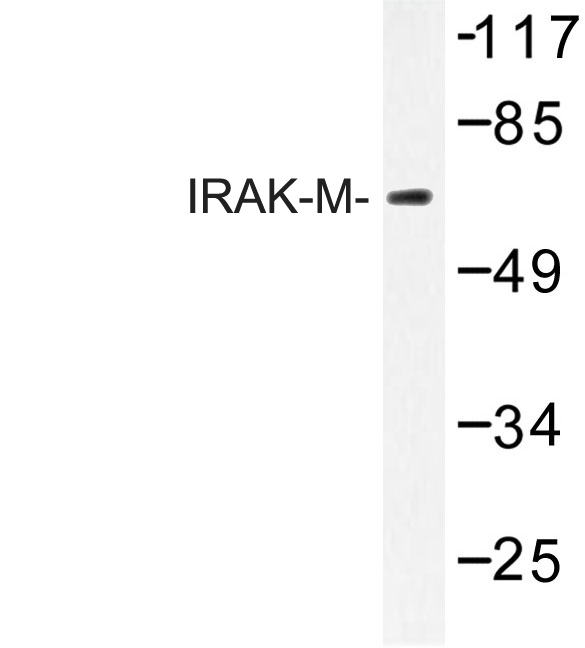 IRAK3 / IRAKM / IRAK-M Antibody - Western blot of IRAK-M (L519) pAb in extracts from K562cells.