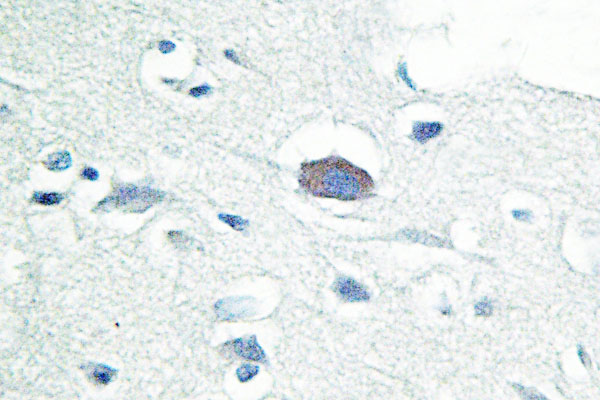 IRAK3 / IRAKM / IRAK-M Antibody - IHC of IRAK-M (L519) pAb in paraffin-embedded human brain tissue.
