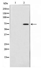 IRAK3 / IRAKM / IRAK-M Antibody - Western blot of K562 cell lysate using IRAK3 Antibody