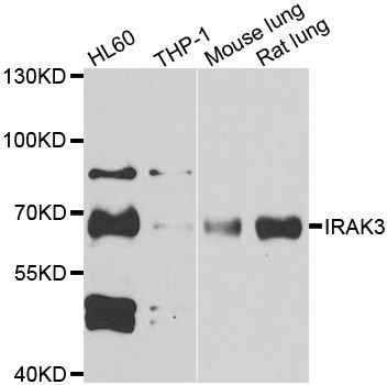 IRAK3 / IRAKM / IRAK-M Antibody - Western blot analysis of extracts of various cell lines, using IRAK3 antibody at 1:1000 dilution. The secondary antibody used was an HRP Goat Anti-Rabbit IgG (H+L) at 1:10000 dilution. Lysates were loaded 25ug per lane and 3% nonfat dry milk in TBST was used for blocking. An ECL Kit was used for detection and the exposure time was 90s.