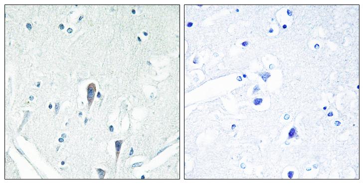 IRAK3 / IRAKM / IRAK-M Antibody - Peptide - + Immunohistochemistry analysis of paraffin-embedded human brain tissue using IRAK3 antibody.