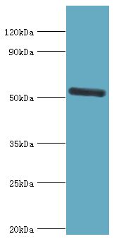 IRAK4 / IRAK-4 Antibody - Western blot. All lanes: Interleukin-1 receptor-associated kinase 4 antibody at 4 ug/ml+Jurkat whole cell lysate. Secondary antibody: Goat polyclonal to rabbit at 1:10000 dilution. Predicted band size: 51 kDa. Observed band size: 51 kDa.