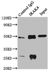 IRAK4 / IRAK-4 Antibody - Immunoprecipitating IRAK4 in MCF-7 whole cell lysate Lane 1: Rabbit control IgG instead of Rabbit anti-human Interleukin-1 receptor-associated kinase 4 polyclonal Antibody(IRAK4 ) in MCF-7 whole cell lysate.For western blotting, a HRP-conjugated Protein G antibody was used as the secondary antibody (1/2000) Lane 2: Rabbit anti-human Interleukin-1 receptor-associated kinase 4 polyclonal Antibody(IRAK4 ) (8µg) + MCF-7 whole cell lysate (500µg) Lane 3: MCF-7 whole cell lysate (10µg)