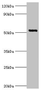 IRAK4 / IRAK-4 Antibody - Western blot All lanes: Interleukin-1 receptor-associated kinase 4 antibody at 4µg/ml + Jurkat whole cell lysate Secondary Goat polyclonal to rabbit IgG at 1/10000 dilution Predicted band size: 52, 38 kDa Observed band size: 52 kDa