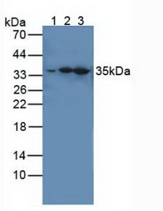 IRAK4 / IRAK-4 Antibody - Western Blot; Sample: Lane1: Human Hela Cells; Lane2: Mouse Spleen Tissue; Lane3: Mouse Brain Tissue.