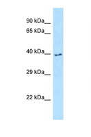 IRAK4 / IRAK-4 Antibody - IRAK4 antibody Western blot of MCF7 Cell lysate. Antibody concentration 1 ug/ml.  This image was taken for the unconjugated form of this product. Other forms have not been tested.