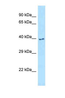IRAK4 / IRAK-4 Antibody - IRAK4 antibody Western blot of MCF7 Cell lysate. Antibody concentration 1 ug/ml.  This image was taken for the unconjugated form of this product. Other forms have not been tested.