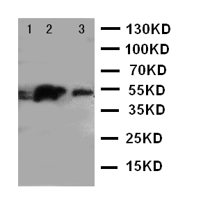 IRAK4 / IRAK-4 Antibody - WB of IRAK4 / IRAK-4 antibody. Lane 1: HELA Cell Lysate. Lane 2: U87 Cell Lysate. Lane 3: MCF-7 Cell Lysate.