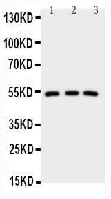 IRAK4 / IRAK-4 Antibody - Anti-IRAK4 antibody, Western blotting Lane 1: HELA Cell LysateLane 2: U87 Cell LysateLane 3: MCF-7 Cell Lysate