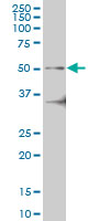 IRAK4 / IRAK-4 Antibody - IRAK4 monoclonal antibody (M04), clone 2D3 Western blot of IRAK4 expression in K-562.