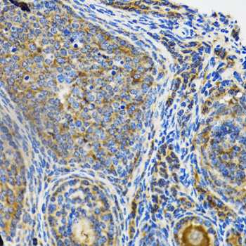 IRAK4 / IRAK-4 Antibody - Immunohistochemistry of paraffin-embedded rat ovary tissue.