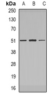 IRAK4 / IRAK-4 Antibody - Western blot analysis of IRAK4 expression in MCF7 (A); Jurkat (B); Raji (C) whole cell lysates.