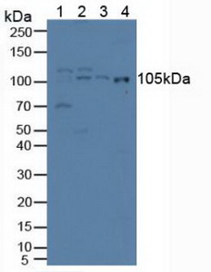 IREB2 / IRP2 Antibody - Western Blot; Sample: Lane1: Porcine Liver Tissue; Lane2: Human Hela Cells; Lane3: Human Lung Tissue; Lane4: Human A549 Cells.
