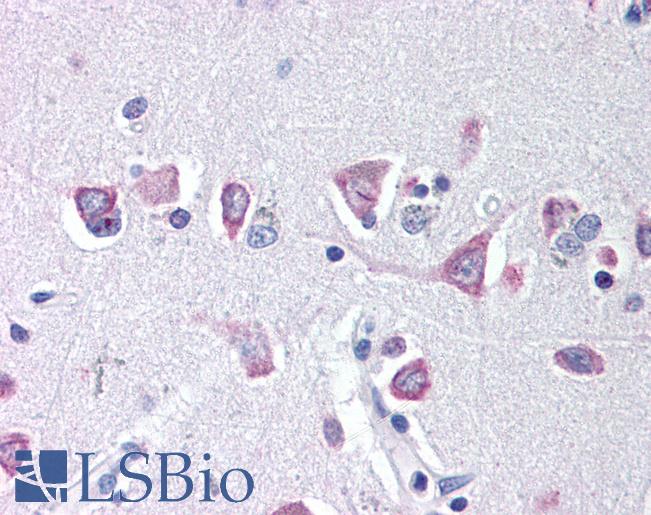 IREB2 / IRP2 Antibody - Anti-IREB2 antibody IHC of human brain. Immunohistochemistry of formalin-fixed, paraffin-embedded tissue after heat-induced antigen retrieval. Antibody concentration 20 ug/ml. This image was taken for the unconjugated form of this product. Other forms have not been tested.
