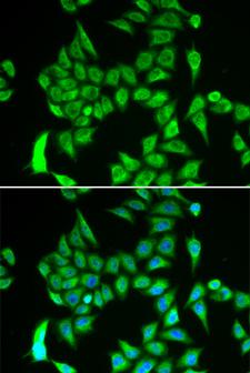 IREB2 / IRP2 Antibody - Immunofluorescence analysis of A549 cell using IREB2 antibody. Blue: DAPI for nuclear staining.