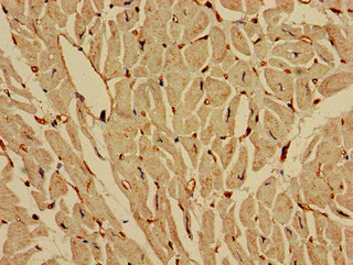IREB2 / IRP2 Antibody - Immunohistochemistry of paraffin-embedded human heart tissue at dilution of 1:100