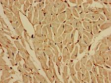IREB2 / IRP2 Antibody - Immunohistochemistry of paraffin-embedded human heart tissue at dilution of 1:100