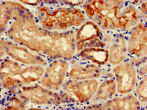 IREB2 / IRP2 Antibody - Immunohistochemistry of paraffin-embedded human kidney tissue at dilution of 1:100