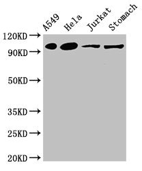 IREB2 / IRP2 Antibody - Western Blot Positive WB detected in:A549 whole cell lysate,Hela whole cell lysate,Jurkat whole cell lysate,Mouse stomach tissue All Lanes:IREB2 antibody at 4µg/ml Secondary Goat polyclonal to rabbit IgG at 1/50000 dilution Predicted band size: 106,38 KDa Observed band size: 106 KDa