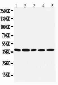 IRF1 / MAR Antibody - WB of IRF1 / IRF-1 /MAR antibody. Lane 1: COLO320 Cell Lysate. Lane 2: U87 Cell Lysate. Lane 3: HELA Cell Lysate. Lane 4: JURKAT Cell Lysate. Lane 5: MCF-7 Cell Lysate.