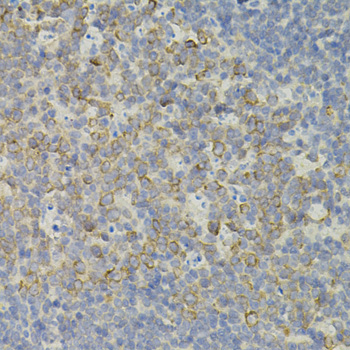 IRF1 / MAR Antibody - Immunohistochemistry of paraffin-embedded mouse spleen tissue.