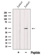 IRF1 / MAR Antibody - Western blot analysis of extracts of HeLa cells using IRF1 antibody. The lane on the left was treated with blocking peptide.