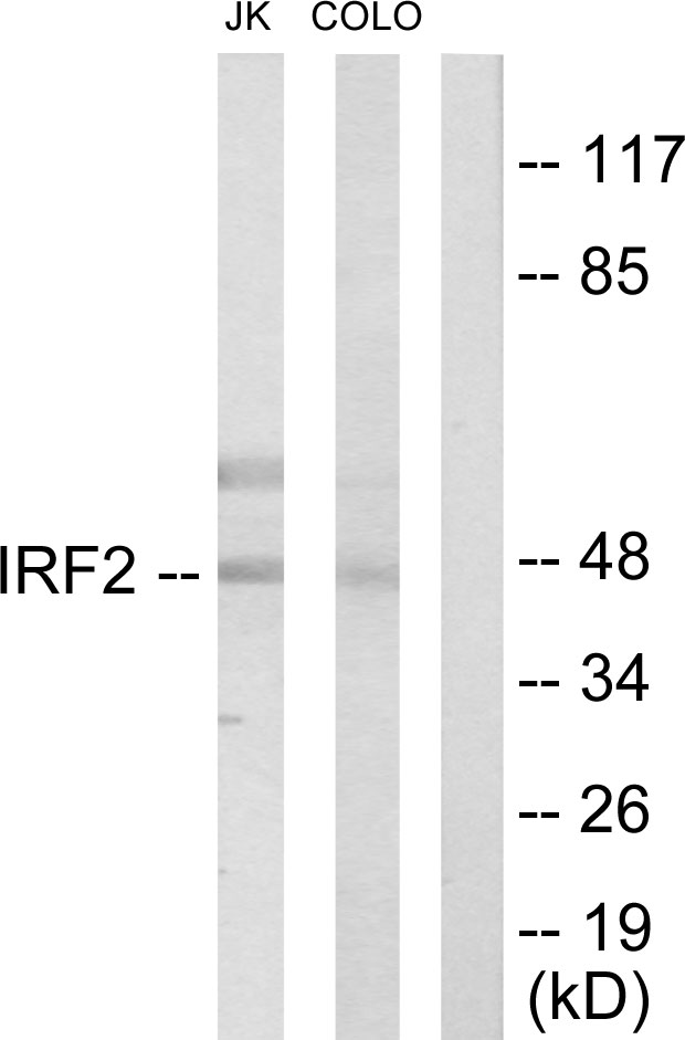 IRF2 Antibody - Western blot analysis of lysates from Jurkat and COLO205 cells, using IRF2 Antibody. The lane on the right is blocked with the synthesized peptide.