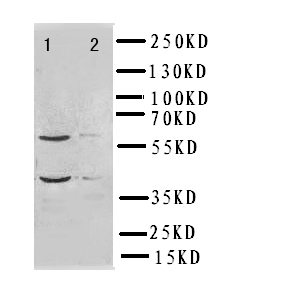 IRF2 Antibody - WB of IRF2 antibody. Lane 1:HELA Cell Lysate. Lane 2:MCF-7 Cell Lysate.