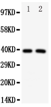 IRF2 Antibody - Anti-IRF2 antibody, Western blotting All lanes: Anti IRF2 at 0.5ug/ml Lane 1: HELA Whole Cell Lysate at 40ug Lane 2: MCF-7 Whole Cell Lysate at 40ug Predicted bind size: 39KD Observed bind size: 39KD