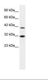 IRF2 Antibody - Jurkat Cell Lysate.  This image was taken for the unconjugated form of this product. Other forms have not been tested.
