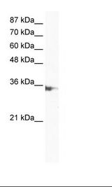 IRF2 Antibody - Jurkat Cell Lysate.  This image was taken for the unconjugated form of this product. Other forms have not been tested.